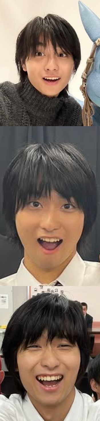 奥平大兼の歯並びアフター